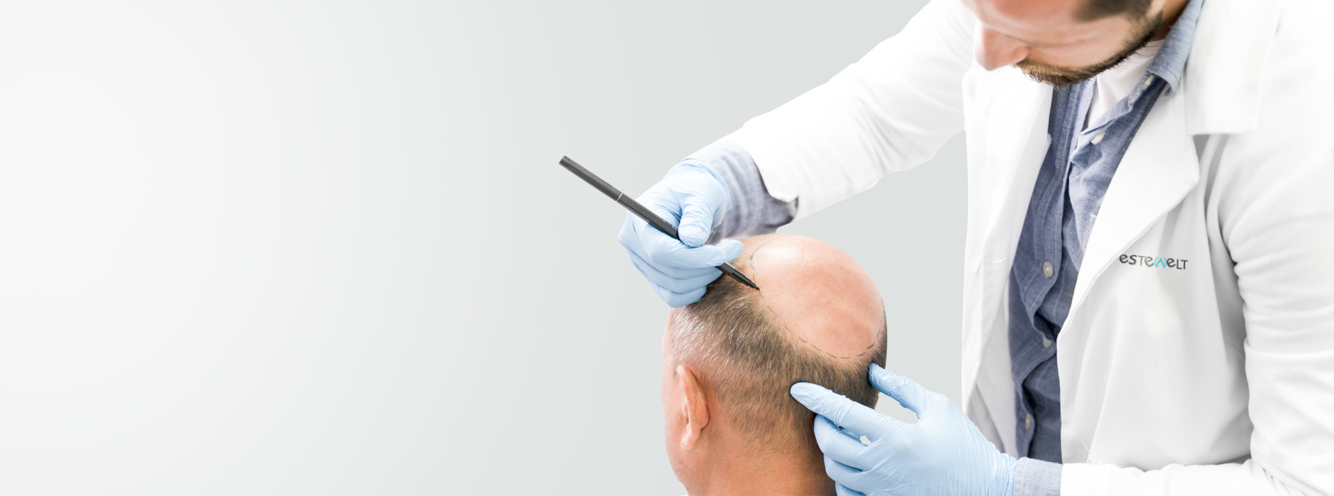 Hair Transplantation