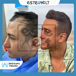 Estewelt
