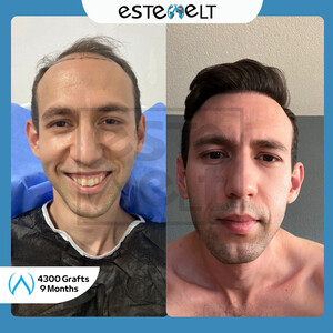 Estewelt