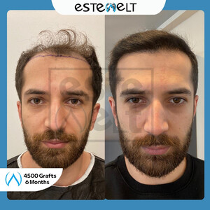 Estewelt