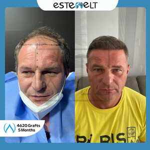 Estewelt