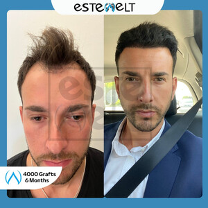 Estewelt