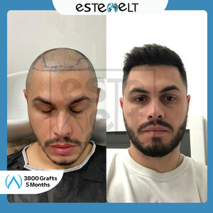 Estewelt