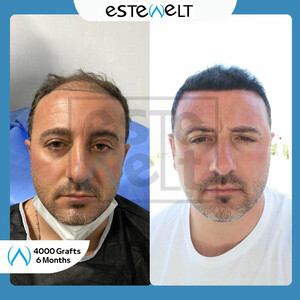Estewelt