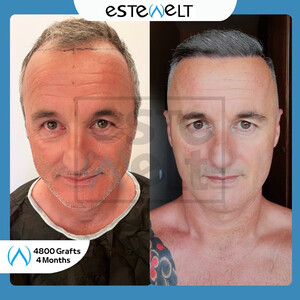 Estewelt