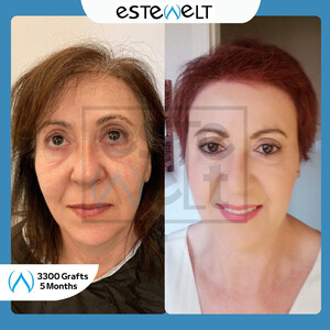 Estewelt