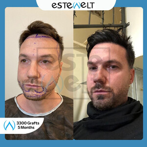 Estewelt