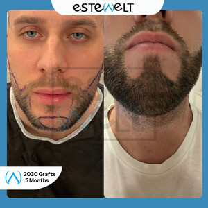 Estewelt