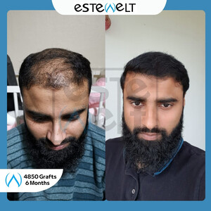 Estewelt