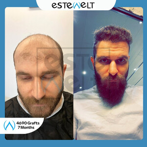 Estewelt
