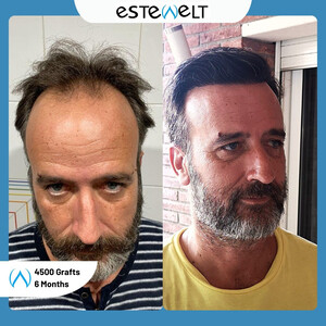 Estewelt