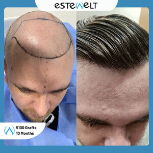Estewelt