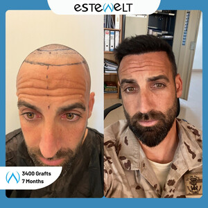 Estewelt
