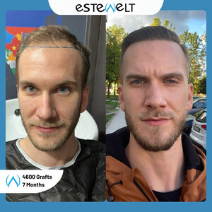 Estewelt