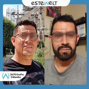 Estewelt