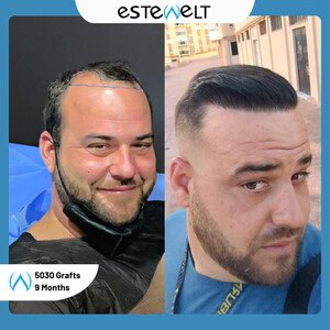 Estewelt