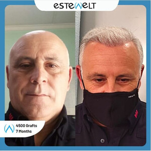 Estewelt