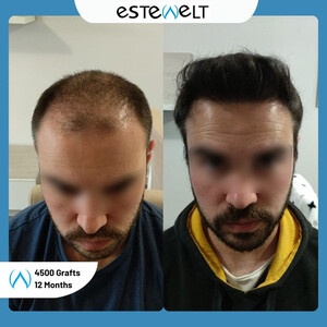 Estewelt