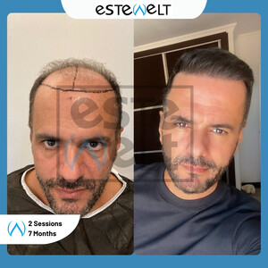 Estewelt