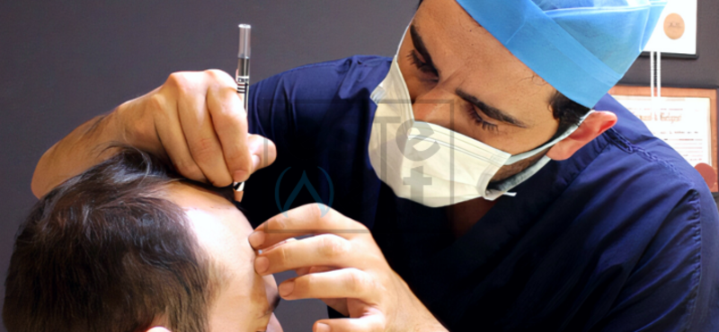 Hair Transplant