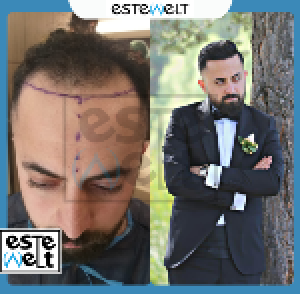 Tugay Tunc