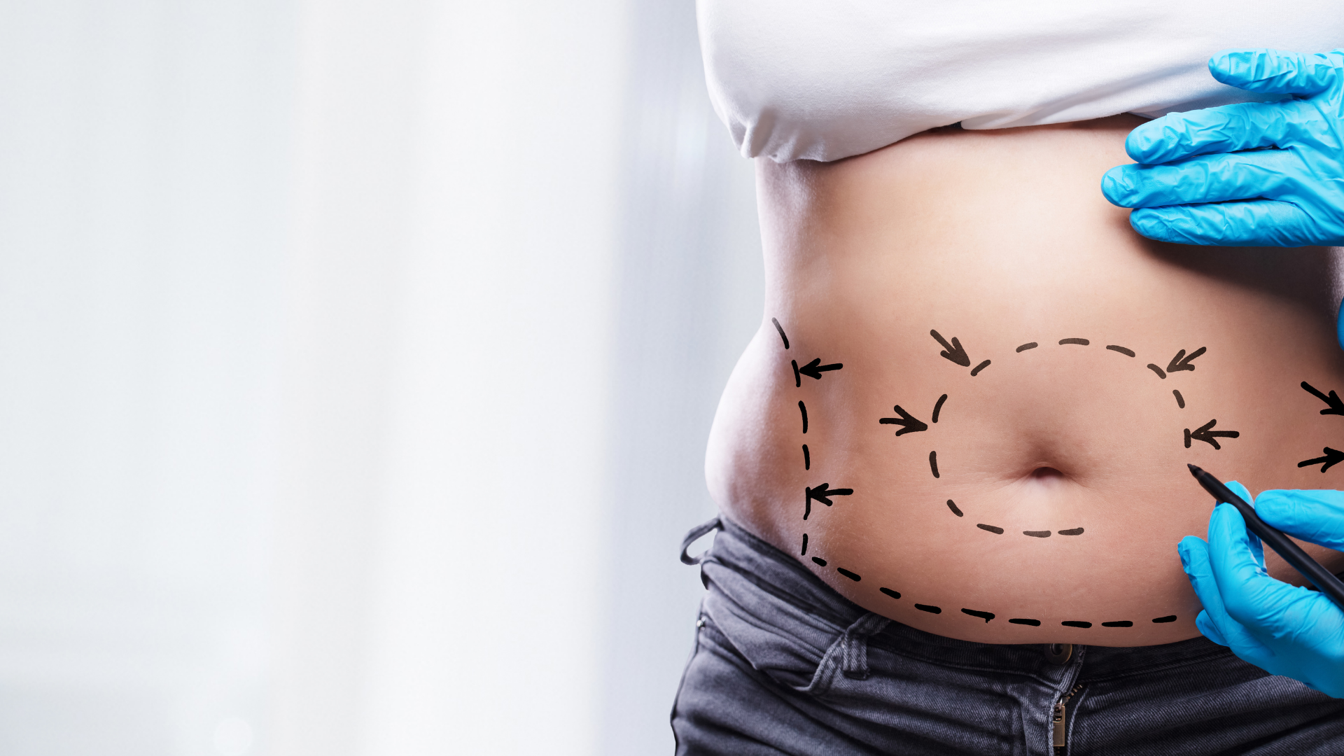 Opération Esthétique