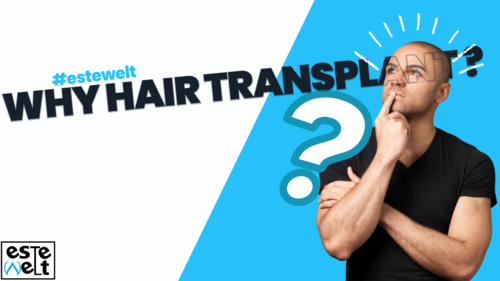 Is a Hair Transplant Permanent?