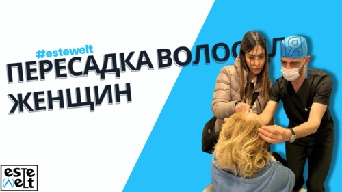 Пересадка волос для женщин